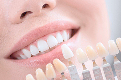 Примерка и подготовка зубов