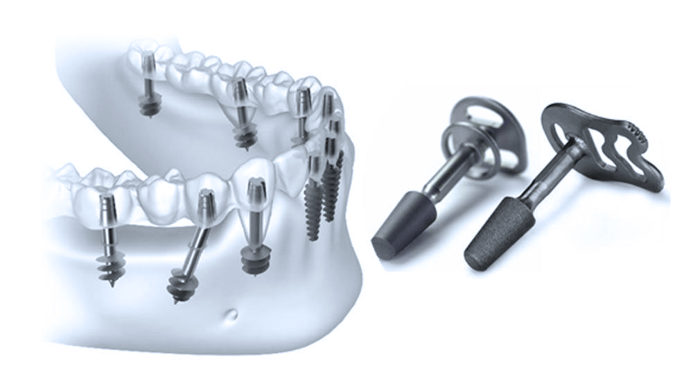 Базальная имплантация зубов в стоматологической клинике Дентал Визит